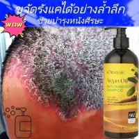 ราคา แชมพูขจัดรังแค ขจัดรังแค แชมพูแก้คัน 500มล. แชมพู ผมมัน ขจัดรังแค ลดอาการคันหนังศีรษะ แก้คัน ลดผมร่วง รักษา เซบอร์ (51653773369)