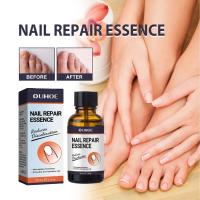 ราคา OUHOE Nail Repair Essence Fungal Nail Treatment ลบ Onychomycosis เล็บเชื้อรา Toe Hand Foot Skin Care (41206819085)