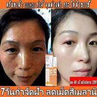 ราคา ครีมทาฝ้า eelhoe ทาฝ้าของแท้ ครีมแก้ฝ้าแท้ๆ ครีมทาฝ้าหนาๆๆ ครีมกำจัดฝ้าvitamin c ครีม แก้ ฝ้า กระ ครีมฝ้ากระลึก【กำจั จุด (24044720635)