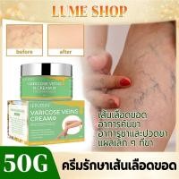 ราคา บรรเทาอาการปวด ครีมทาเส้นเลือดขอด ส่งเสริมการไหลเวียนของเลือด รักษาขาให้สวย ครีมเส้นเลือดขอด (26443689439)