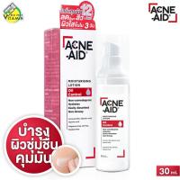 ราคา Acne Aid Moisturising Lotion Oil Control แอคเน่ เอด มอยซ์เจอร์ไรซิ่ง โลชั่น ออยล์ คอนโทรล [30 ml.] (41012803376)