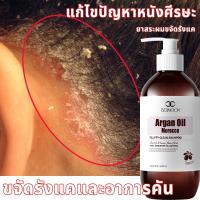 ราคา ยาสระผมขจัดรังแค แชมพูรังแค ยาสระผม 500ml ขจัดรังแค ลดคันหัว หยุดอาการคัน ลดผมร่วง แชมพูรักษาเชื้อราบนหนังศรีษะ (26320556384)