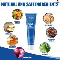 ราคา Fade Stretch Mark Repair Cream Trauma Stretch Marks Relief Cream สําหรับผู้ชายและผู้หญิงทุกสภาพผิว (41900397058)