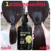 ราคา 【จัดส่งวันนั้น️】แชมพูแก้ผมร่วง แชมพูปลูกผมดก แชมพูลดผมร่วง แก้ผมร่วง แชมพูปลูกผม (18280746524)