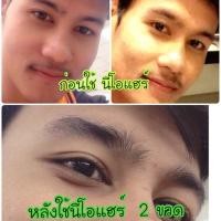 ราคา โลชั่นปลูกผมปลูกคิ้ว นีโอแฮร์ (697998018)