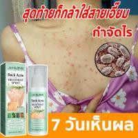 ราคา JAYSUING สเปรย์รักษาสิวที่หลัง สิวหน้าอก สิวใบหน้า สูตรแพทย์แผนไทย Acne Body Spray สเปรย์ฉีดสิวที่ผิวกาย 120มล (24208047561)