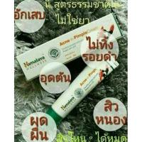 ราคา Himalaya Herbals Acne-n-Pimple Cream, 20g. ครีมแต้มสิวอักเสบสิวผด (1550026138)