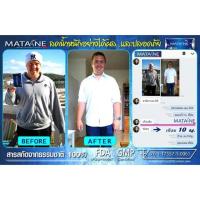 ราคา Matane มาตาเนะ เสริมอาหารต้านความอ้วน ลดน้ำหนัก (143455494)