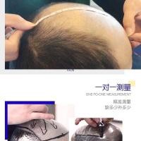 ราคา วิกผมผู้ชาย ผมปลอม วิกผมสั้น วิกผมไม้ชายไม่มีรอยต่อที่มองไม่เห็นเปลี่ยน แฮร์ไลน์ ชายผมจริงด้านบนวิกผมชิ้นเปลี่ยนบล็อก (40978085201)