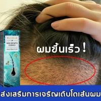 ราคา สเปรย์ปลูกผม เร่งผมขึ้นใหม่ น้ำยาปลูกผมดก เซรั่มปลูกผม น้ำยาปลูกผม ฟื้นฟูผม ป้องกันผมร่วง เซรั่มบำรุงผม เร่งผมขึ้นใหม่ ร (23670734711)