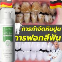 ราคา มูสฟอกฟันขาว ขัดฟันขาว ยาสีฟันขจัดหินปูน 60ml ยาสีฟันฟอกฟันขาว ยาสีฟันฟันขาว ช่องปาก ยาสีฟันหินปูน ยาสีฟันจัดฟันฟันขาว (24790518740)