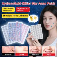 ราคา Star Glitter Patch Collagen Acne Patch Sticker Glitter Collagen Patch (41677406610)
