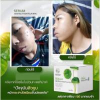 ราคา #พรทิน่า เซรั่มใบบัวบก #พีทิน่าเซรั่ม #พรทิน่าสบู่ #พรทิน่า โสมขมิ้น #พรทิน่า กันแดด (20037144117)