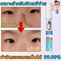 ราคา 【NEW】เลเซอร์ลบรอยแผลเป็น รักษารอยแผลเป็น แผลผ่าตัด ทาแผลเป็น ทาแผลเป็นนูน ครีมทาแผลเป็น ครีมลบแผลเป็น (28636164703)