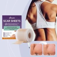 ราคา Ximonth แผ่นแผลเป็นซิลิโคน Silicone Scar Tape 4cm*150cm เทปซิลิโคนสำหรับรอยแผลเป็น, แผ่นซิลิโคนสำหรับรอยแผลเป็น (46304080131)