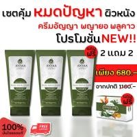 ราคา ครีมกับสบู่รักษาผิวหนัง ลดรอยแดง กลากเกลื้อน ผิวหนังอักเสบ รักษาโรคผิวหนัง น้ำเหลืองไม่ดีคัน ลดอักเสบ ครีมอัญญา (2แถม2) (21573061050)