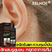 ราคา EELHOE 100ml แชมพูแก้ผมร่วง แชมพูคัน ยาสระผมรังแค ดูแลหนังศีรษะ บำรุงรากผม ยาสระผมเชื้อรา แชมพูขจัดรังแค แชมพูขจัดรังแค (25821353854)
