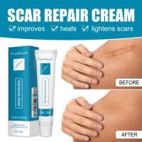 ราคา West&Month Acne Treatment Skin Repair Scar Removal Cream Gel Cuts Stretch Marks for Face Body (29288217420)