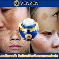 ราคา VENZEN ครีมทาฝ้ากระ ครีมทาฝ้าหนาๆ ครีมแก้ฝ้ากระ ครีมบำรุงหน้า ครีมทาหน้าขาว ครีมรักษาฝ้า ครีมทาฝ้าลึก ครีมหน้าขาวใส กระจ (15565077205)