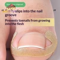ราคา [Willbehot-t] 10/30/50 แผ่นคุด Toe Nail Correction Stier กาวเล็บเท้า Patch Foot Corrector Pedicure Health Care เครื่องมือ Toe Treatment Pad [ใหม่] (54607318811)