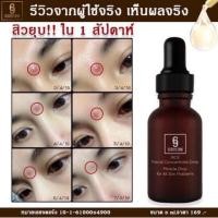 ราคา เซรั่มแก้หน้าพัง rice drop แก้ปัญหาผิว ฝ้า สิว หลุมสิว กระจุดด่างดำ (2310517986)