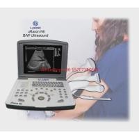 ราคา uRason N6 Customization OB GYN Echocardiography Machine Laptop Portable Ultrasound Scanner ecograf (40629182169)