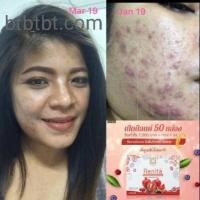 ราคา ส่งฟรี คอลลาเจนเรนิต้า Renita (2210171274)
