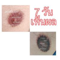 ราคา หัวนมดำแค่ไหน ก็ชมพูได้ บำรุงให้หัวนมชมพูได้ ด้วยครีมหัวนมชมพู การันตีโดยตัวแทนครีมหัวนมชมพูทุกคน (25928582870)