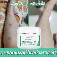 ราคา 【มีสินค้า】ALIVER ครีมลดรอยแผลเป็น 50ml ลบรอยครีมแผลเป็น ครีมรักษาแผลเป็น ยาทาแผลเป็น ลดรอยแผลเป็น (43656500936)