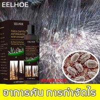 ราคา EELHOE แชมพูขจัดรังแค แชมพูคัน ยาสระผมรังแค 100ml ขจัดรังแค หยุดอาการคัน ลดผมร่วง ยาสระผมขจัดรังแค (24019667934)