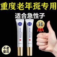 ราคา ครีมกําจัดจุดลบจุดผู้สูงอายุเมลานินจุดใบหน้าลบครีมบนมือกลับมือที่แข็งแกร่งลบผลิตภัณฑ์ของแท้20260407 (47408344333)