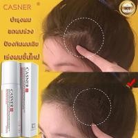 ราคา CASNER น้ำยาปลูกผม ปลูกผม น้ำยาเร่งผมยาว เซรั่มปลูกผม น้ำยาปลูกผม เร่งผมขึ้นใหม่ เซรั่มบำรุงผม รักษาผม รักษาผมร่วง (9627731935)