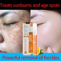 ราคา ทาฝ้า ครีมลอกฝ้า ครีมแก้ฝ้าถาวร ครีม แก้ ฝ้า กระ vitamin c ครีมทาฝ้าหนาๆ ครีมทาฝ้า ครีมฝ้ากระลึก กำจั จุดด่างดำ (22913737201)