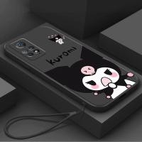 ราคา เคส Redmi note 11Pro 4G Redmi note 11Pro 5G Redmi note11Pro+ 5G Redmi note 11 Pro Plus 5G Redmi note 12Pro 4GTpuแฟชั่นlanyard soft case RXGSเคสโทรศัพท์ (27160911569)