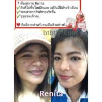 ราคา ส่งฟรี คอลลาเจน เรนิต้า Renita bt (2210198214)