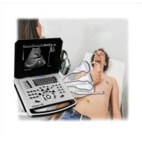 ราคา URason N8 Priced to Sell Digital Portable B/W Ultrasound Scanner for Human OB GYN Echocardiography (55705586403)