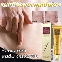 ราคา 【มีสินค้าพร้อมจัดส่ง】peimei 30g ครีมลดรอยแผลเป็น แผลเป็น ลดเลือนแผลผ่าตัดการคลอด แผลผ่าตัด ทาแผลเป็นนูน ลบรอยแผลเปน (43754809579)