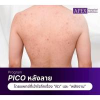 ราคา [E-Voucher] APEX โปรแกรม Pico หลัง by แพทย์ เลเซอร์ลดรอย หลังบน หรือ หลังล่าง ทดลอง 2,500 บาท (48657232149)