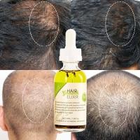 ราคา Rosemary Hair Oil for hair growth and damage repair 50ml (50107723988)