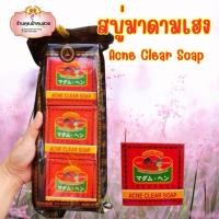 ราคา (แพ็ค 3 ก้อน) สบู่มาดามเฮง Acne Clear Soap สูตรสิว ผดผื่น (29035799153)