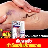 ราคา ไม่ได้ผลคืนเงิน ครีมทาเส้นเลือดขอด รักษาขาให้สวย ครีมเส้นเลือดขอด กลับคืนสุขภาพเท้า Varicose Vein Cream (42423293274)