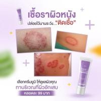 ราคา yumi cream ครีมทา กลากเกลื้อน ครีมรักษาโรคสะเก็ดเงิน ผื่นคัน โรคผิวหนัง หายขาด เห็นผลจริง พร้อมส่ง (26185735970)