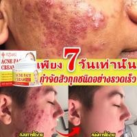 ราคา ครีมแต้มสิว ครีมแต้มสิว กําจัดสิว ลดสิว ลดรอยสิว กําจัดสิวและรอยสิว ละลายสิวหัวดํา ซ่อมแซมใบหน้า (40250864411)