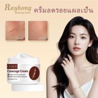 ราคา OUHOE ครีมลดรอยแผลเป็น รักษารอยแผลเป็น ซ่อมแซมผิวหนัง ลดรอยแผลเป็นและรอยแดงจากสิว ลดรอยแตกลายสีขาว (46352469500)